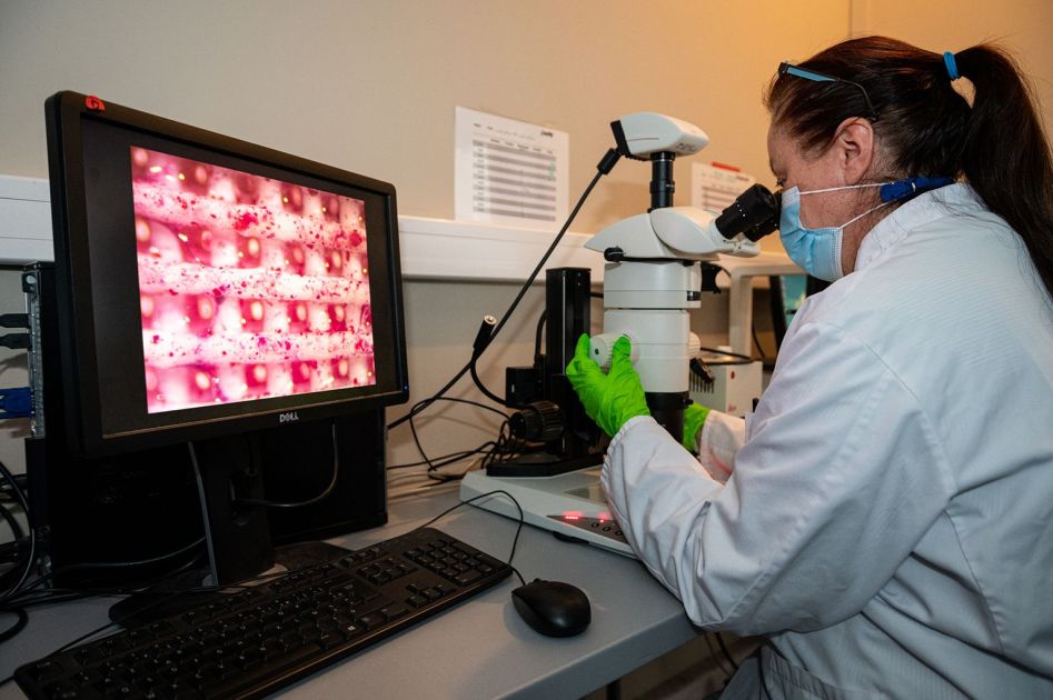 Cancer Biology :: Le doctorat à l'université de Bordeaux